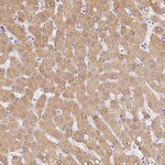 ACVR1B Antibody in Immunohistochemistry (Paraffin) (IHC (P))