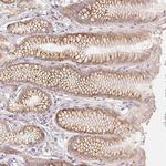 ACVR1B Antibody in Immunohistochemistry (Paraffin) (IHC (P))