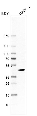 ACVR1B Antibody in Western Blot (WB)