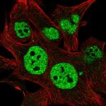 TESK2 Polyclonal Antibody