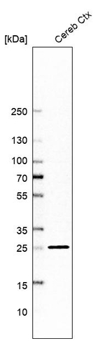 MBP Antibody in Western Blot (WB)