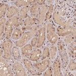 MAPKAPK2 Polyclonal Antibody