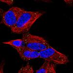 CERK Polyclonal Antibody