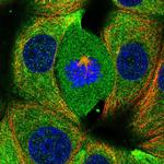 RABGAP1 Polyclonal Antibody