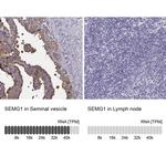 SEMG1 Antibody in Immunohistochemistry (Paraffin) (IHC (P))