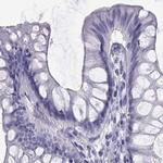 SEMG1 Antibody in Immunohistochemistry (Paraffin) (IHC (P))