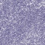 SEMG1 Antibody in Immunohistochemistry (Paraffin) (IHC (P))