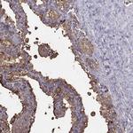 SEMG1 Antibody in Immunohistochemistry (Paraffin) (IHC (P))