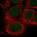 SGPP1 Polyclonal Antibody