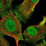 RNF8 Polyclonal Antibody