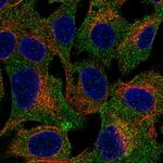 TRPC4AP Polyclonal Antibody
