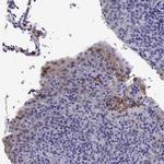 DOK5 Polyclonal Antibody