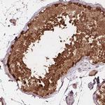 HIF1AN Antibody in Immunohistochemistry (Paraffin) (IHC (P))