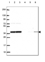 PP1 beta Antibody in Western Blot (WB)