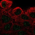 ZNF432 Polyclonal Antibody