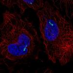 ROR gamma Polyclonal Antibody