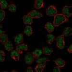 RAG2 Polyclonal Antibody