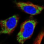 UGT8 Polyclonal Antibody