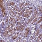 PFKFB4 Polyclonal Antibody