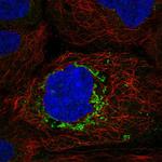 ABHD10 Polyclonal Antibody