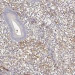 IGFBP4 Antibody in Immunohistochemistry (Paraffin) (IHC (P))