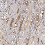 IGFBP4 Antibody in Immunohistochemistry (Paraffin) (IHC (P))