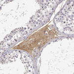 IGFBP4 Antibody in Immunohistochemistry (Paraffin) (IHC (P))