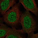 HEC1 Polyclonal Antibody