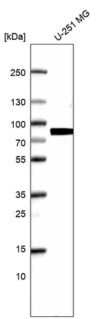 HEC1 Antibody in Western Blot (WB)