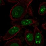 BOP1 Polyclonal Antibody