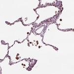gp210 Antibody in Immunohistochemistry (Paraffin) (IHC (P))