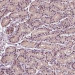 gp210 Polyclonal Antibody