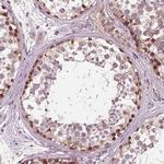 gp210 Antibody in Immunohistochemistry (Paraffin) (IHC (P))