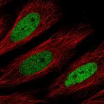 C/EBP delta Polyclonal Antibody