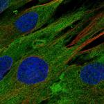 EphB1 Polyclonal Antibody