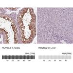 RUVBL2 Antibody in Immunohistochemistry (Paraffin) (IHC (P))