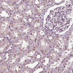 RUVBL2 Antibody in Immunohistochemistry (Paraffin) (IHC (P))