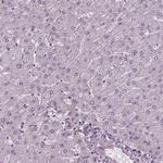 RUVBL2 Antibody in Immunohistochemistry (Paraffin) (IHC (P))