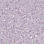 RUVBL2 Antibody in Immunohistochemistry (Paraffin) (IHC (P))