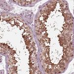 RUVBL2 Antibody in Immunohistochemistry (Paraffin) (IHC (P))