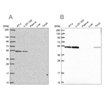 RUVBL2 Antibody in Western Blot (WB)