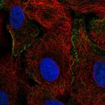 Crk Antibody in Immunocytochemistry (ICC/IF)