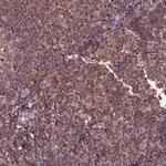 IL31RA Polyclonal Antibody