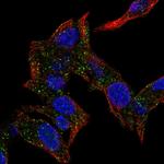 CSRP2BP Polyclonal Antibody