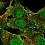 BCORL1 Polyclonal Antibody