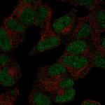 POLR3D Polyclonal Antibody