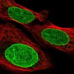 GTF3C3 Polyclonal Antibody