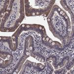 CYP2S1 Polyclonal Antibody