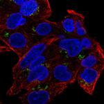 GDPD5 Polyclonal Antibody