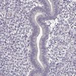 FSH beta Antibody in Immunohistochemistry (Paraffin) (IHC (P))